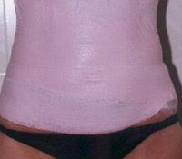 /album/bielenda/barriga-gesso-rosa-jpg1/